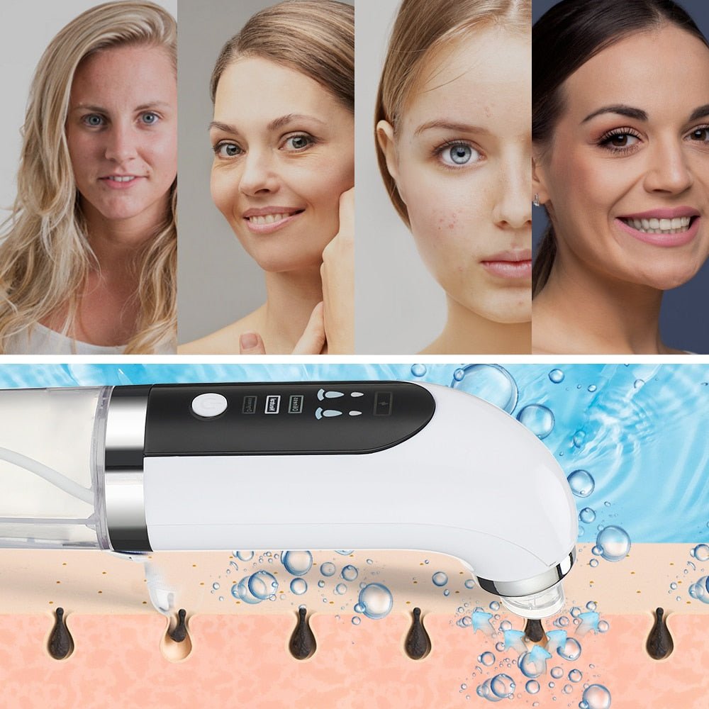 ClearFace HydroVac